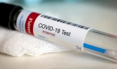 Gambia; Coronavirus Cases Top 2,000 As 244 New Cases Are Seen