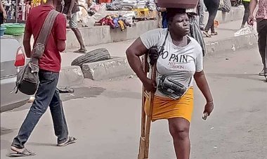 Hunger will kill me, daughter, grandma if I don’t hawk in Lagos traffic – 26-year-old single mother amputated at 11