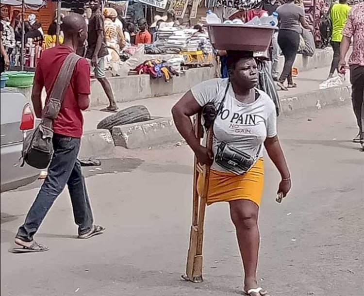 Hunger will kill me, daughter, grandma if I don’t hawk in Lagos traffic – 26-year-old single mother amputated at 11