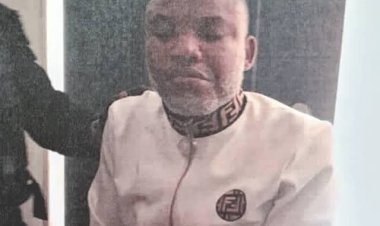 Nnamdi Kanu’s Eyesight Failing, Still Not Allowed To Change Clothes — Lawyer