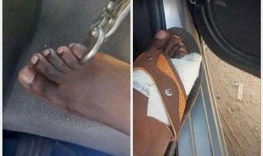 Zimbabwean man faces criminal charges for raising viral ‘false alarm’ as human toe dealer