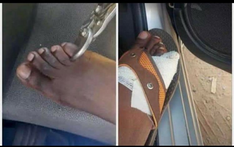 Zimbabwean man faces criminal charges for raising viral ‘false alarm’ as human toe dealer